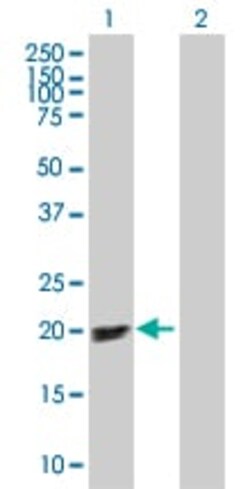Abcam&nbsp;p19 INK4d overexpression 293T lysate (whole cell).