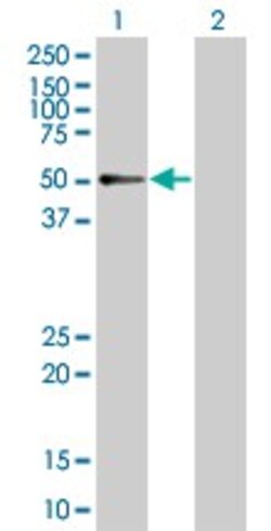 Abcam&nbsp;RXRG overexpression 293T lysate (whole cell).