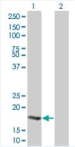 Abcam&nbsp;Ube2B overexpression 293T lysate (whole cell).
