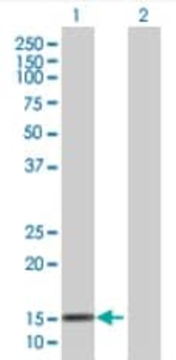 Abcam&nbsp;Ube2L6 overexpression 293T lysate (whole cell).