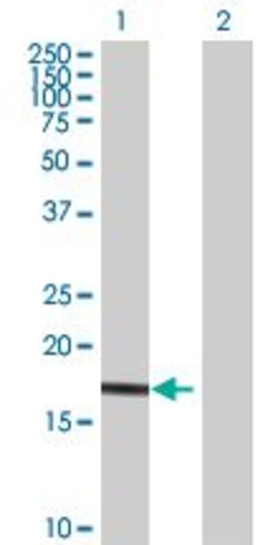 Abcam&nbsp;Ube2G1 overexpression 293T lysate (whole cell).