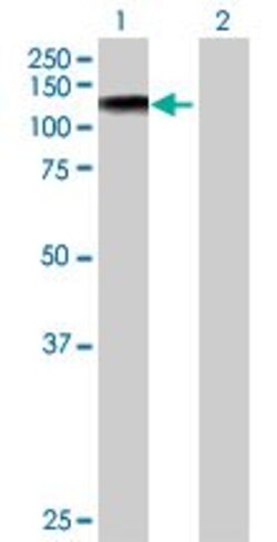 Abcam&nbsp;SNF2H overexpression 293T lysate (whole cell).