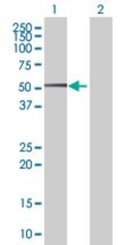 Abcam SDS3 overexpression 293T lysate (whole cell).