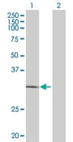 Abcam&nbsp;ING4 overexpression 293T lysate (whole cell).