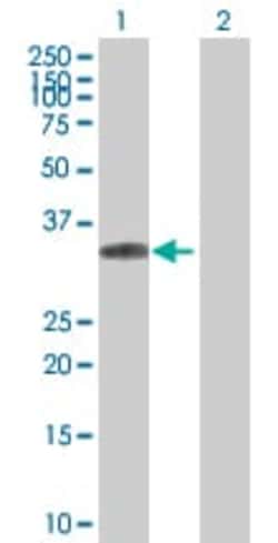 Abcam&nbsp;ING1 overexpression 293T lysate (whole cell).
