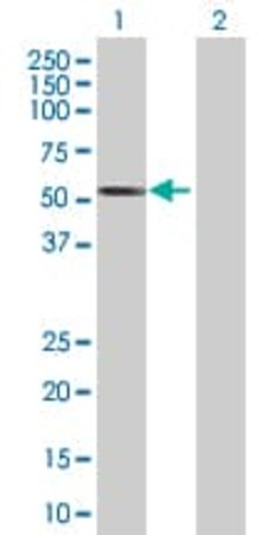 Abcam&nbsp;hHR23b overexpression 293T lysate (whole cell).