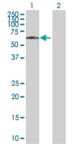 Abcam&nbsp;hHR23b overexpression 293T lysate (whole cell).