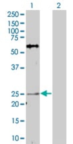 Abcam&nbsp;AKIP overexpression 293T lysate (whole cell).