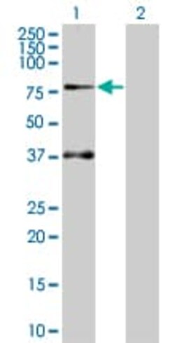 Abcam&nbsp;SOCS5 overexpression 293T lysate (whole cell).