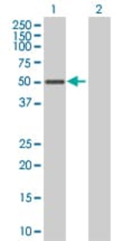 Abcam&nbsp;SOCS4 overexpression 293T lysate (whole cell).
