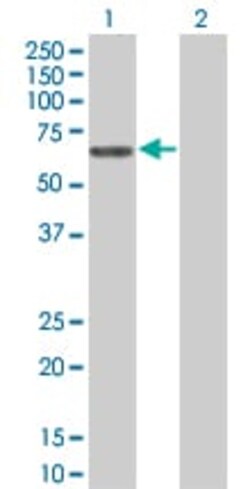 Abcam&nbsp;MMP10 overexpression 293T lysate (whole cell).