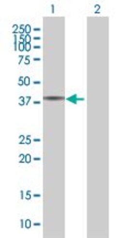 Abcam&nbsp;MBD3 overexpression 293T lysate (whole cell).