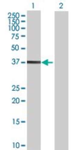 Abcam&nbsp;Cdk6 overexpression 293T lysate (whole cell).