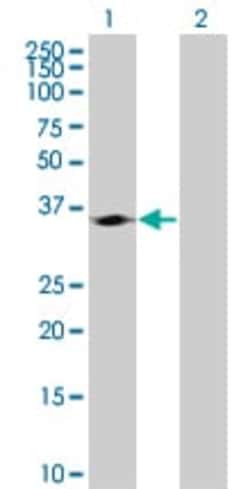 Abcam&nbsp;Cdk4 overexpression 293T lysate (whole cell).