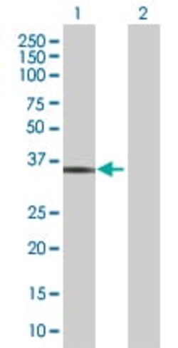 Abcam&nbsp;Estrogen Sulfotransferase overexpression 293T lysate (whole cell).