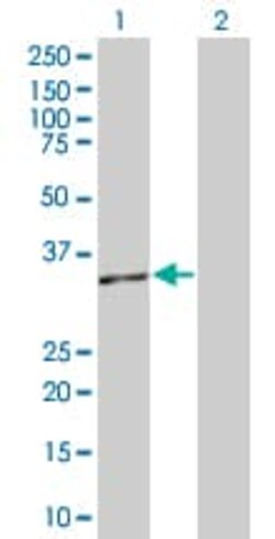 Abcam&nbsp;RFC2 overexpression 293T lysate (whole cell).