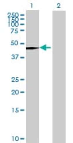 Abcam&nbsp;Cytochrome P450 2A6 overexpression 293T lysate (whole cell).