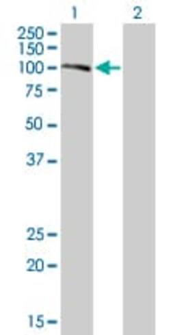 Abcam&nbsp;Calpastatin overexpression 293T lysate (whole cell).