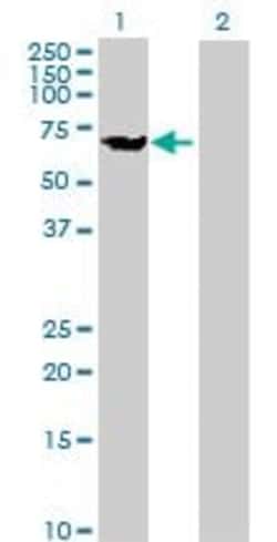 Abcam&nbsp;KLC1 overexpression 293T lysate (whole cell).