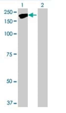Abcam&nbsp;NFAT5 overexpression 293T lysate (whole cell).