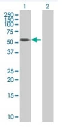 Abcam&nbsp;PICK1 overexpression 293T lysate (whole cell).