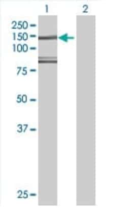 Abcam&nbsp;HIP1R overexpression 293T lysate (whole cell).