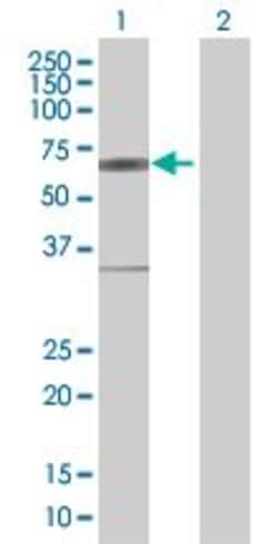 Abcam&nbsp;IRF5 overexpression 293T lysate (whole cell).