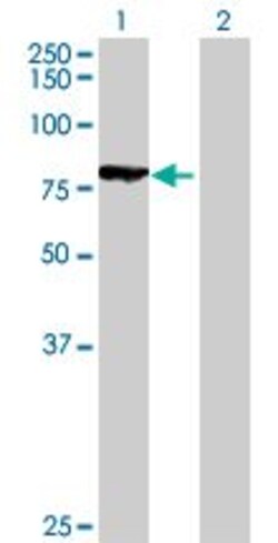 Abcam Rad17 overexpression 293T lysate (whole cell).