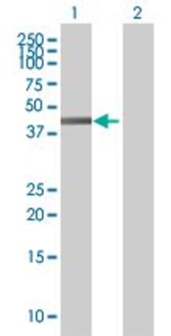 Abcam&nbsp;Flotillin 2 / ESA overexpression 293T lysate (whole cell).