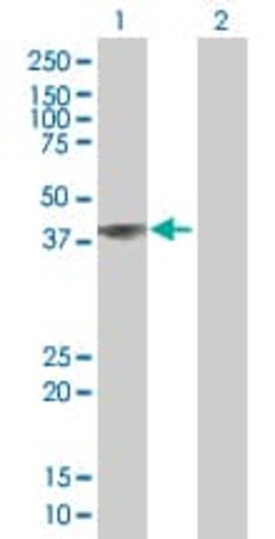 Abcam&nbsp;Flotillin 2 / ESA overexpression 293T lysate (whole cell).