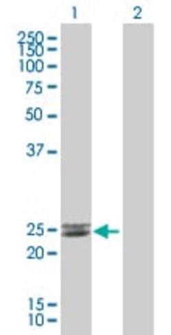 Abcam&nbsp;Endothelin 1 overexpression 293T lysate (whole cell).
