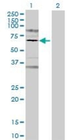 Abcam&nbsp;Prolactin Receptor overexpression 293T lysate (whole cell).