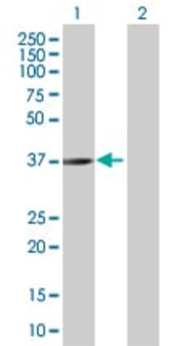 Abcam&nbsp;STEAP1 overexpression 293T lysate (whole cell).