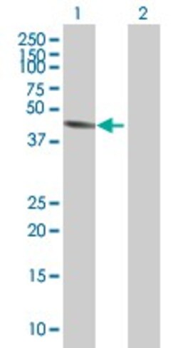 Abcam&nbsp;Cytochrome P450 2E1 overexpression 293T lysate (whole cell).