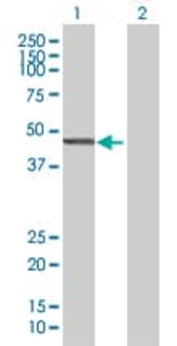 Abcam&nbsp;Cytohesin 2 overexpression 293T lysate (whole cell).