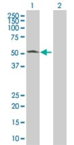 Abcam&nbsp;CaMKII alpha overexpression 293T lysate (whole cell).