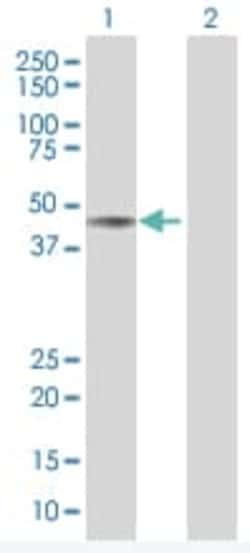 Abcam&nbsp;APE1 overexpression 293T lysate (whole cell).