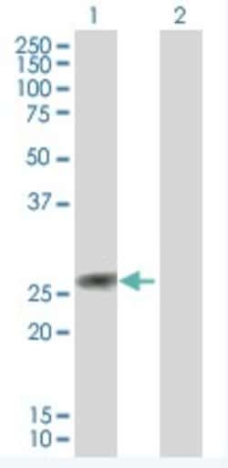 Abcam&nbsp;TIA1 overexpression 293T lysate (whole cell).