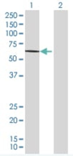 Abcam&nbsp;PTIP overexpression 293T lysate (whole cell).