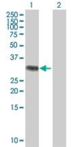 Abcam&nbsp;RYBP overexpression 293T lysate (whole cell).