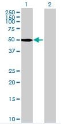 Abcam&nbsp;PAK1 overexpression 293T lysate (whole cell).