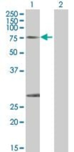 Abcam&nbsp;Calpain 1 overexpression 293T lysate (whole cell).