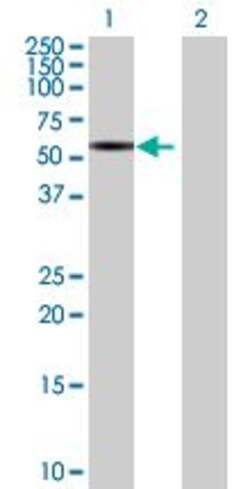 Abcam PACSIN1 overexpression 293T lysate (whole cell).