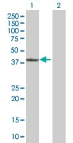 Abcam&nbsp;GRAP2 overexpression 293T lysate (whole cell).