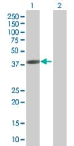 Abcam&nbsp;GRAP2 overexpression 293T lysate (whole cell).
