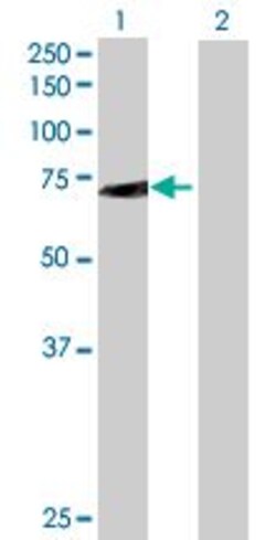 Abcam&nbsp;SWAP70 overexpression 293T lysate (whole cell).