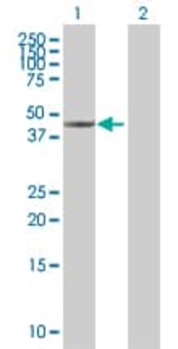 Abcam&nbsp;Cytokeratin 17 overexpression 293T lysate (whole cell).