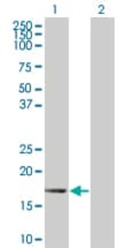 Abcam&nbsp;ID3 overexpression 293T lysate (whole cell).