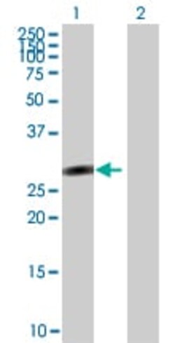 Abcam&nbsp;SALL2 overexpression 293T lysate (whole cell).