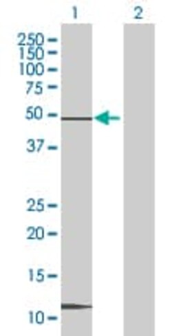 Abcam AIBZIP overexpression 293T lysate (whole cell).